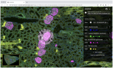 Rendering a pyramidal, multiplexed immunofluorescence OME-TIFF image of a human kidney using additive blending to render four image channels into a single RGB image in the client.