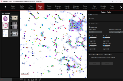 HistoMetriX software for AI-powered histology and digital pathology image analysis
