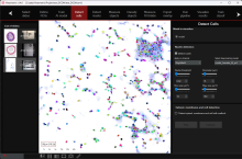 HistoMetriX software for AI-powered histology and digital pathology image analysis